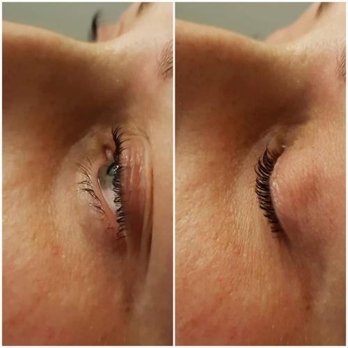 Réhaussement de cils + soin lash botox + teinture de cils Après