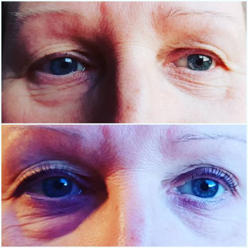 Réhaussement de cils + soin lash botox + teinture de cils Avant/Après